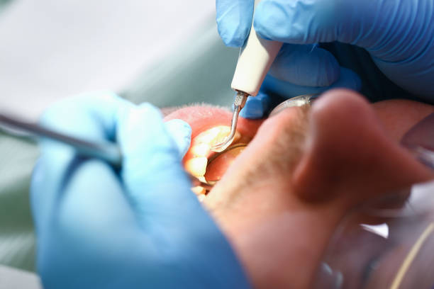 Best Tooth Pain Emergency Relief  in Marine, IL
