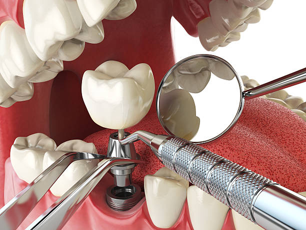 Best Root Canal Emergency Dentist  in Marine, IL