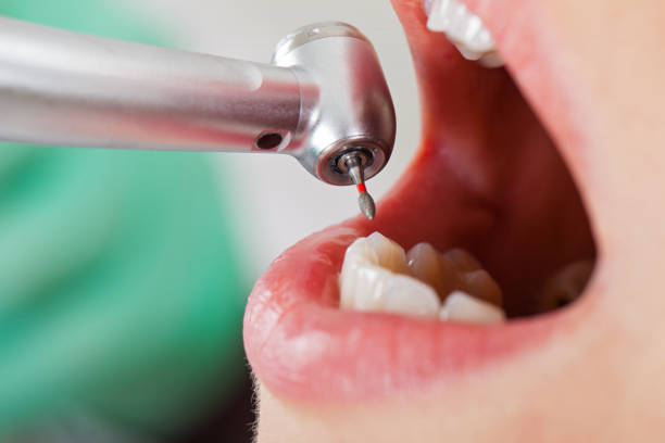 Best Walk-In Dentist Near Me  in Marine, IL